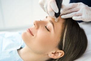 Micro-needling treatment