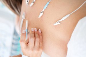 Electroacupuncture on a patient's back