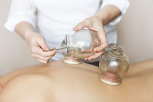 Patient receiving Cupping Therapy