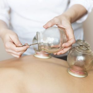 Patient receiving Cupping Therapy